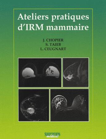 Couverture du livre « Ateliers pratiques d'IRM mammaire » de J Chopier et Sophie Taieb et Luc Ceugnart aux éditions Sauramps Medical