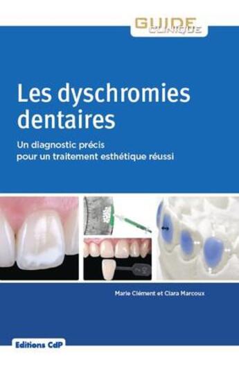 Couverture du livre « Les dyschromies dentaires ; un diagnostic précis pour un traitement esthétique réussi » de Marie Clement et Clara Marcoux aux éditions Cahiers De Protheses