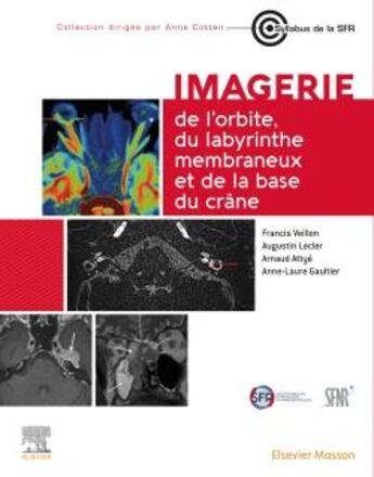 Couverture du livre « Imagerie de l'orbite, du labyrinthe membraneux et de la base du crâne » de Francis Veillon et Augustin Lecler aux éditions Elsevier-masson