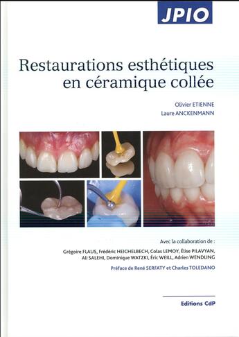 Couverture du livre « Restaurations esthétiques en céramique collée » de Laure Anckenmann et Olivier Etienne aux éditions Cahiers De Protheses