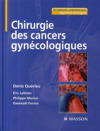 Couverture du livre « Chirurgie des cancers gynécologiques » de Guerleu et Leblanc aux éditions Elsevier-masson