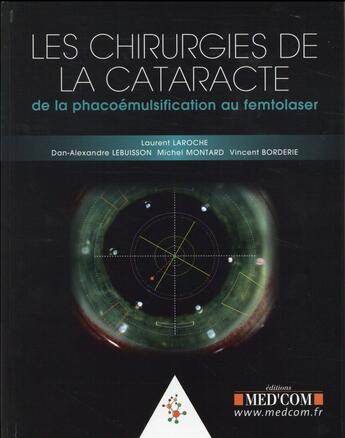 Couverture du livre « Les chirurgie de la cataracte. de la phacoemulsification au femtolaser » de Laroche L Lebuisson aux éditions Med'com