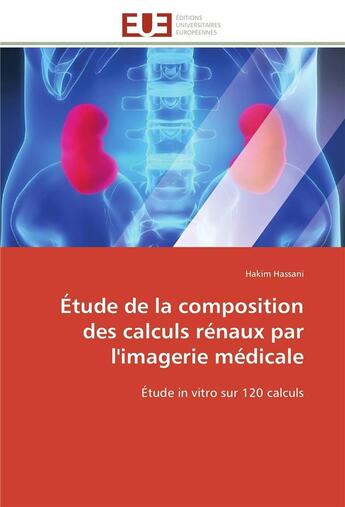 Couverture du livre « Etude de la composition des calculs renaux par l'imagerie medicale » de Hassani-H aux éditions Editions Universitaires Europeennes