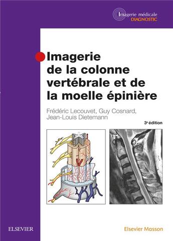 Couverture du livre « Imagerie de la colonne vertébrale et de la moelle épinière (3e édition) » de Jean-Louis Dietemann et Guy Cosnard et Frederic Lecouvet aux éditions Elsevier-masson