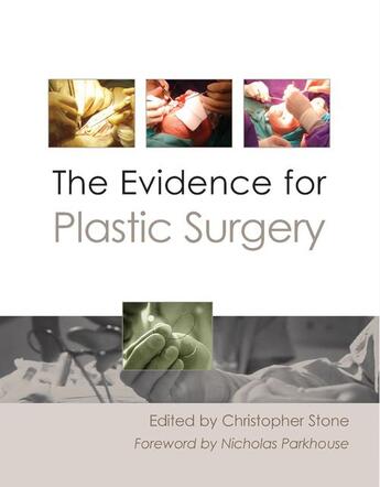 Couverture du livre « The Evidence for Plastic Surgery » de Christopher Stone aux éditions Tfm Publishing Ltd