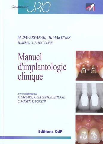 Couverture du livre « Manuel D Implantologie Clinique » de Cdp aux éditions Cahiers De Protheses