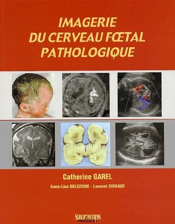 Couverture du livre « Imagerie du cerveau foetal pathologique » de Garel/Delezoide aux éditions Sauramps Medical