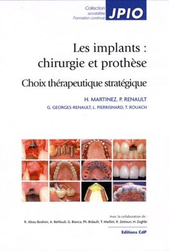 Couverture du livre « Les implants : chirurgie et prothèse » de  aux éditions Cahiers De Protheses