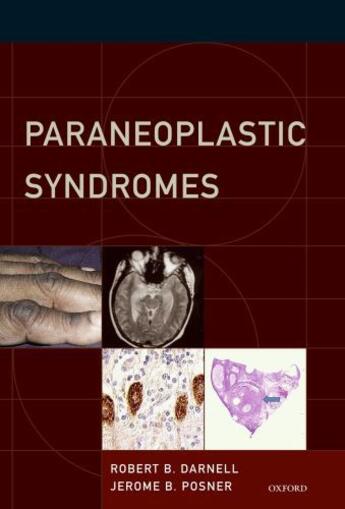 Couverture du livre « Paraneoplastic Syndromes » de Posner Jerome B aux éditions Oxford University Press Usa