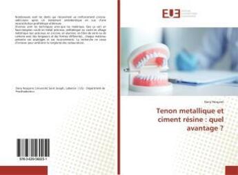 Couverture du livre « Tenon metallique et ciment resine : quel avantage ? » de  aux éditions Editions Universitaires Europeennes