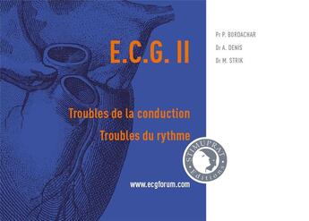 Couverture du livre « Ecg ii : troubles de la conduction, troubles du rythme » de Pr/Dr aux éditions Stimuprat