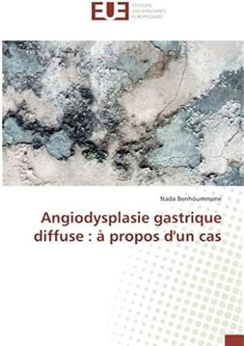 Couverture du livre « Angiodysplasie gastrique diffuse : à propos d'un cas » de Nada Benhoummane aux éditions Editions Universitaires Europeennes