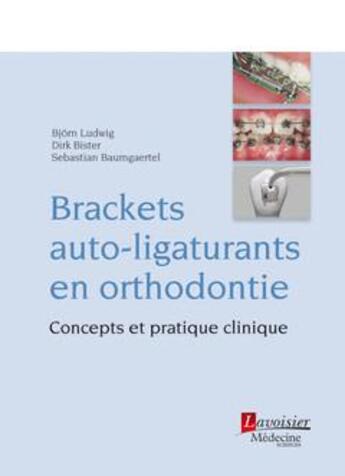 Couverture du livre « Brackets auto-ligaturants en orthodontie ; concepts et pratique clinique » de Bjorn Ludwig et Dirk Bister et Sebastien Baumgaertel aux éditions Lavoisier Medecine Sciences