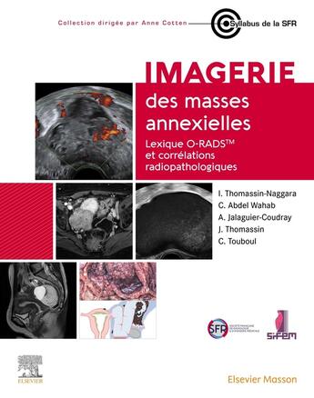 Couverture du livre « Imagerie des masses annexielles : Lexique O-RADS et corrélations radiopathologiques » de Isabelle Thomassin-Naggara aux éditions Elsevier-masson