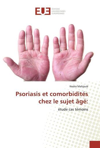 Couverture du livre « Psoriasis et comorbidites chez le sujet age: » de Mahjoub Nedra aux éditions Editions Universitaires Europeennes