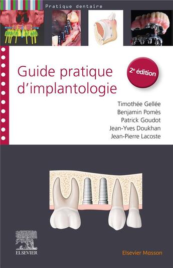 Couverture du livre « Guide pratique d'implantologie (2e édition) » de Patrick Goudot et Jean-Pierre Lacoste et Jean-Yves Doukhan et Timothee Gellee et Benjamin Pomes aux éditions Elsevier-masson