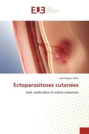 Couverture du livre « Ectoparasitoses cutanees - gale, pediculose et autres nuisances » de Bagula Safari Jean aux éditions Editions Universitaires Europeennes