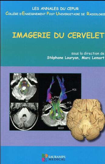 Couverture du livre « Imagerie du cervelet » de Stephane Louryan et Marc Lemort aux éditions Sauramps Medical