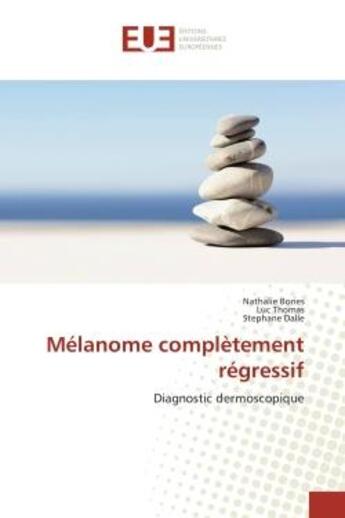 Couverture du livre « Melanome completement regressif - diagnostic dermoscopique » de Bories/Thomas/Dalle aux éditions Editions Universitaires Europeennes