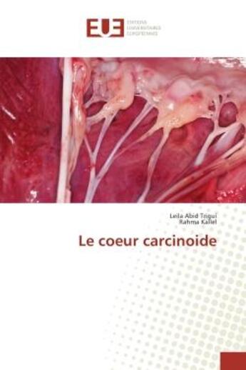 Couverture du livre « Le coeur carcinoide » de Leila Trigui aux éditions Editions Universitaires Europeennes