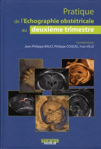 Couverture du livre « Pratique de l'échographie obstétricale au deuxième timestre (2e édition) » de Philippe Coquel et Bault Jean-Philippe et Yves Ville aux éditions Sauramps Medical