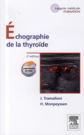 Couverture du livre « Echographie de la thyroide » de Tramalloni aux éditions Elsevier-masson