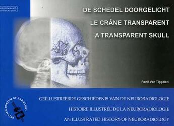 Couverture du livre « Le crâne transparent ; histoire illustrée de la neuroradiologie » de Rene Van Tiggelen aux éditions Memogrames