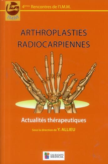Couverture du livre « Arthroplasties radiocarpiennes » de Y Allieu aux éditions Sauramps Medical
