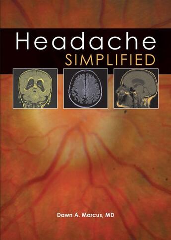 Couverture du livre « Headache Simplified » de Dawn Marcus aux éditions Tfm Publishing Ltd