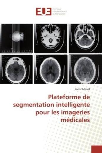 Couverture du livre « Plateforme de segmentation intelligente pour les imageries médicales » de Jarrar Manel aux éditions Editions Universitaires Europeennes