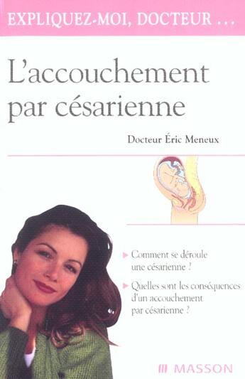 Couverture du livre « L'accouchement par cesarienne » de Meneux Eric aux éditions Elsevier-masson