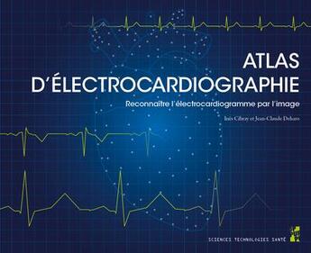 Couverture du livre « Atlas d'électrocardiographie : Reconnaître l'électrocardiogramme par l'image » de Jean-Claude Deharo et Ines Cibray aux éditions Pu De Provence