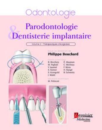 Couverture du livre « Parodontologie & dentisterie implantaire Tome 2 ; thérapeutiques chirurgicales » de Philippe Bouchard aux éditions Lavoisier Medecine Sciences