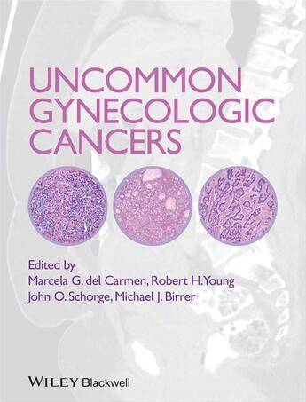 Couverture du livre « Uncommon Gynecologic Cancers » de John O. Schorge et Marcela Del Carmen et Robert H. Young aux éditions Wiley-blackwell