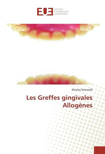 Couverture du livre « Les greffes gingivales allogenes » de Giannelli Nicolas aux éditions Editions Universitaires Europeennes