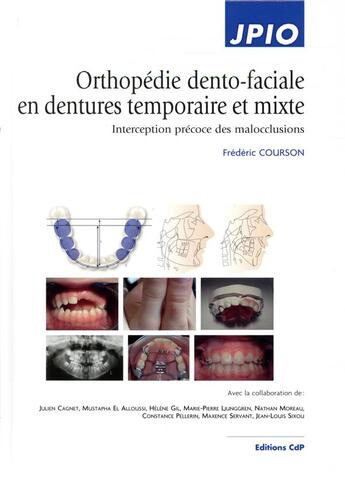 Couverture du livre « Orthopédie dento-faciale en dentures temporaire et mixte ; interception précoce des malocclusions » de Frederic Courson aux éditions Cahiers De Protheses