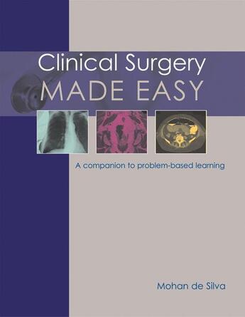 Couverture du livre « Clinical Surgery Made Easy » de Mohan De Silva aux éditions Tfm Publishing Ltd