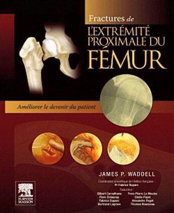 Couverture du livre « Fractures de l'extrémité proximale du fémur ; améliorer le devenir du patient » de James P. Waddell aux éditions Elsevier-masson