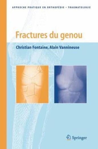 Couverture du livre « Fractures du genou » de Christian Fontaine aux éditions Springer