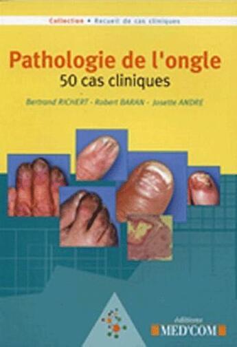 Couverture du livre « Pathologie de l'ongle ; 50 cas cliniques » de Richert et Baran aux éditions Med'com