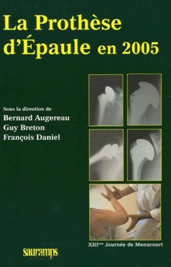 Couverture du livre « La prothèse d'épaule en 2005 ; XIIIème journée de Menucourt » de Bernard Augereau aux éditions Sauramps Medical