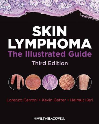 Couverture du livre « Skin Lymphoma » de Lorenzo Cerroni et Kevin Gatter et Kerl Helmut aux éditions Wiley-blackwell