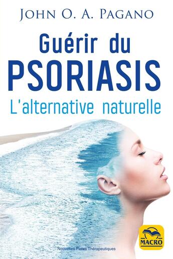 Couverture du livre « Guérir du psoriasis : L'alternative naturelle » de John O.A. Pagano aux éditions Macro Editions