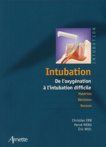 Couverture du livre « Intubation de l oxygenation a l intubation difficile - de l'oxygenation a l'intubation difficile » de Erb/Wiel/Menu aux éditions Arnette