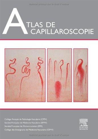 Couverture du livre « Atlas de capillaroscopie » de  aux éditions Elsevier-masson