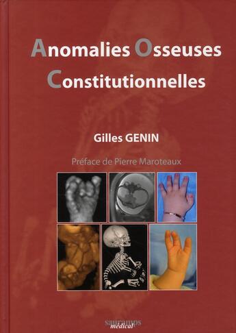 Couverture du livre « Anomalies osseuses constiutionnelles » de Genin Gilles/Co aux éditions Sauramps Medical