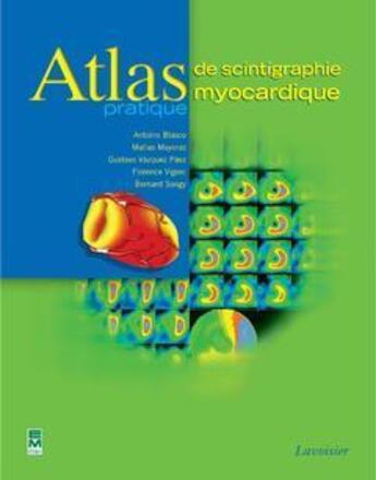 Couverture du livre « Atlas pratique de scintigraphie myocardique » de Vazquez/Mayoraz aux éditions Tec Et Doc