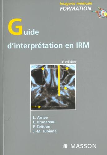 Couverture du livre « Guide d'interpretation en irm ; 3e edition » de Lionel Arrive et Frederic Zeitoun et Tubiana Jean-Michel et Laurent Brunereau aux éditions Elsevier-masson