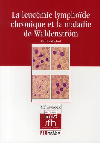 Couverture du livre « La leucémie lymphoïde chronique et la maladie de Waldenström » de Leblond Veroniq aux éditions John Libbey