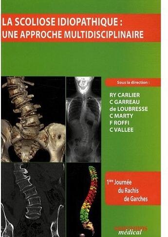 Couverture du livre « La scoliose idiopathique ; une approche multidisciplinaire » de R.Y. Carlier et C. Garreau et De Loubresse et C. Marty et F. Roffi et C. Vallee aux éditions Sauramps Medical